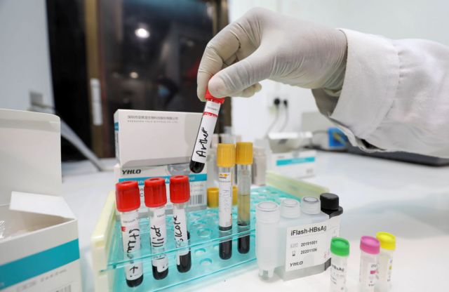 Γερμανία : Νέα κριτήρια για την υποβολή σε τεστ για κοροναϊό, λόγω υπερφόρτωσης των εργαστηρίων