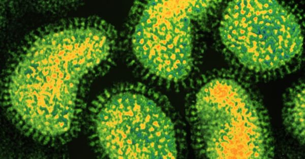 Πότε η γρίπη γίνεται φονική