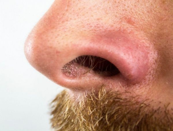 Μαύρα στίγματα : Έτσι θα τα αντιμετωπίσετε μέσα σε λίγα λεπτά