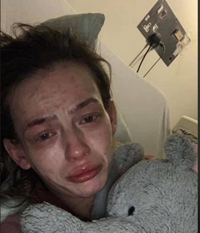 Γυναίκα αποφάσισε να αποτοξινωθεί από τα ναρκωτικά και κυριολεκτικά «μεταμορφώθηκε»