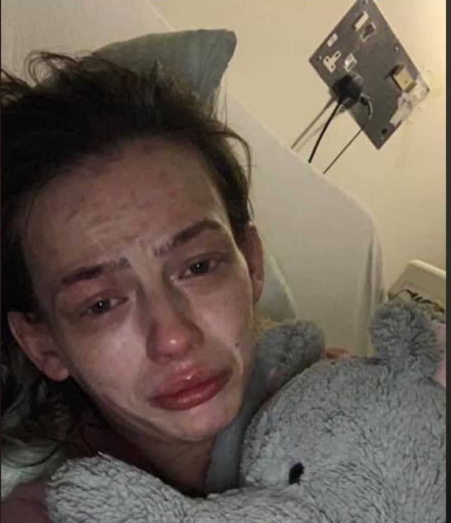 Γυναίκα αποφάσισε να αποτοξινωθεί από τα ναρκωτικά και κυριολεκτικά «μεταμορφώθηκε»