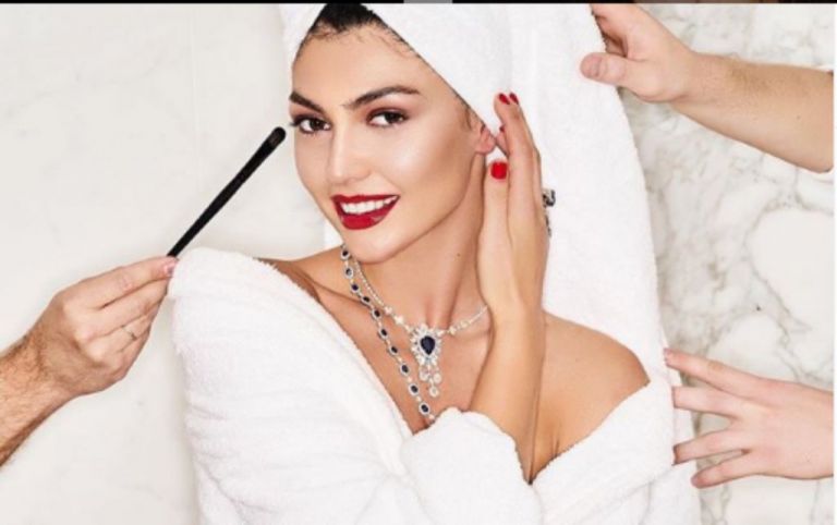 Κέισι Μίζιου : «Πονούσαν τα κόκαλα μου σε υπερβολικό βαθμό»