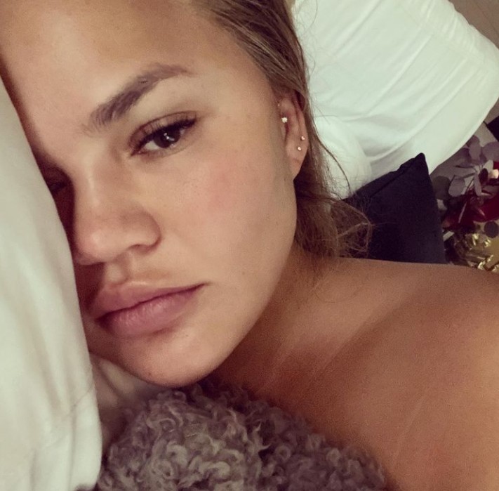 Κρίσι Τέιγκεν : Δείχνει το σώμα της μετά την αποβολή του παιδιού της