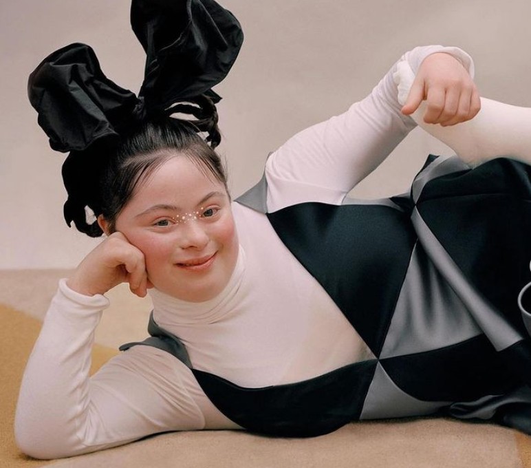 Έλι Γκολντστάιν: Γράφει ιστορία το πρώτο μοντέλο με σύνδρομο Down