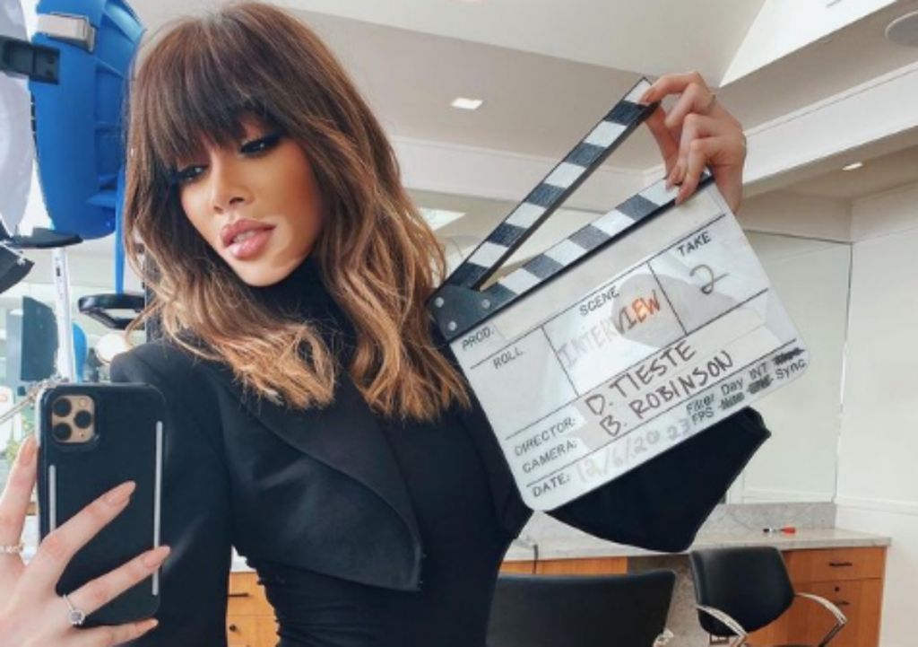 Winnie Harlow : Αποχωρίστηκε την μακριά της κόμμη για ένα τολμηρό pixie cut