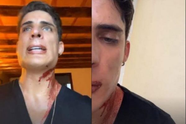 Βίντεο : Ο σύντροφος της μητέρας του Νεϊμάρ δέχτηκε επίθεση με μαχαίρι