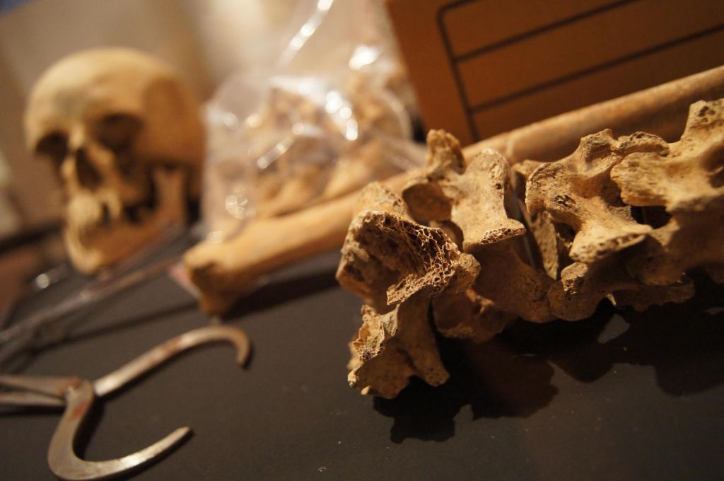Όπλα από ανθρώπινα οστά χρησιμοποιούνταν στη χαμένη γη του Ντόγκερλαντ