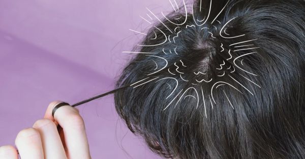 Scalp Popping : Όταν το κρανίο κάνει… «κρακ»