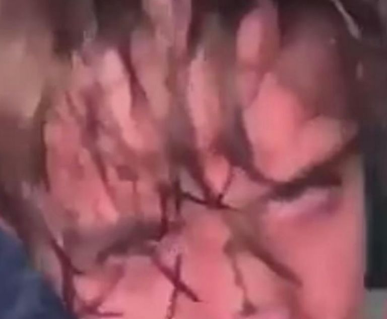 Νέα Υόρκη : Έρευνα μετά από βίντεο που δείχνει άγριο ξυλοδαρμό εφήβου