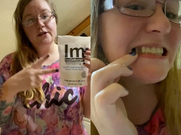 Tik Tok : Έφηβοι χρήστες κάνουν tutorials για λεύκανση και βάζουν δόντια μόνοι τους