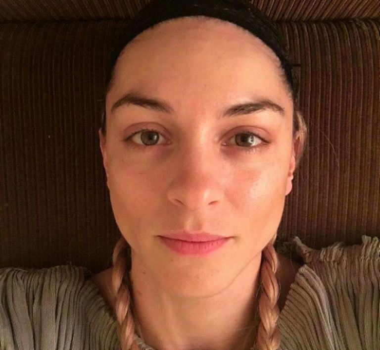 Γιούλικα Σκαφιδά : Το story που ανέβασε για το πρόβλημα υγείας που την οδήγησε στο νοσοκομείο