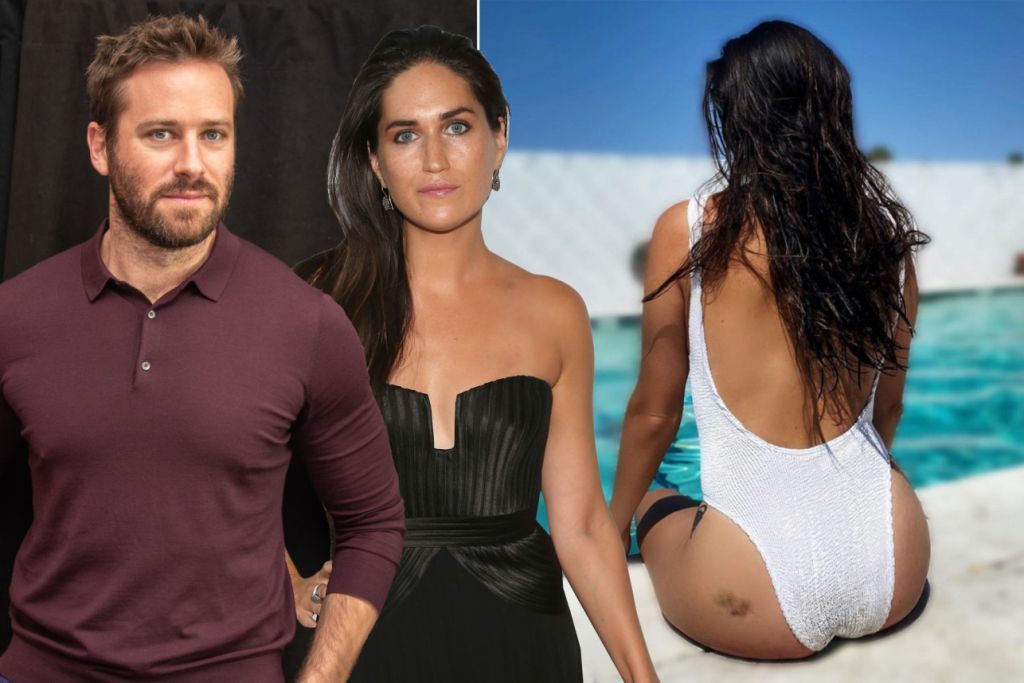 Άρμι Χάμερ : Πρώην σύντροφός τον κατηγορεί δείχνοντας μώλωπα στα οπίσθιά της