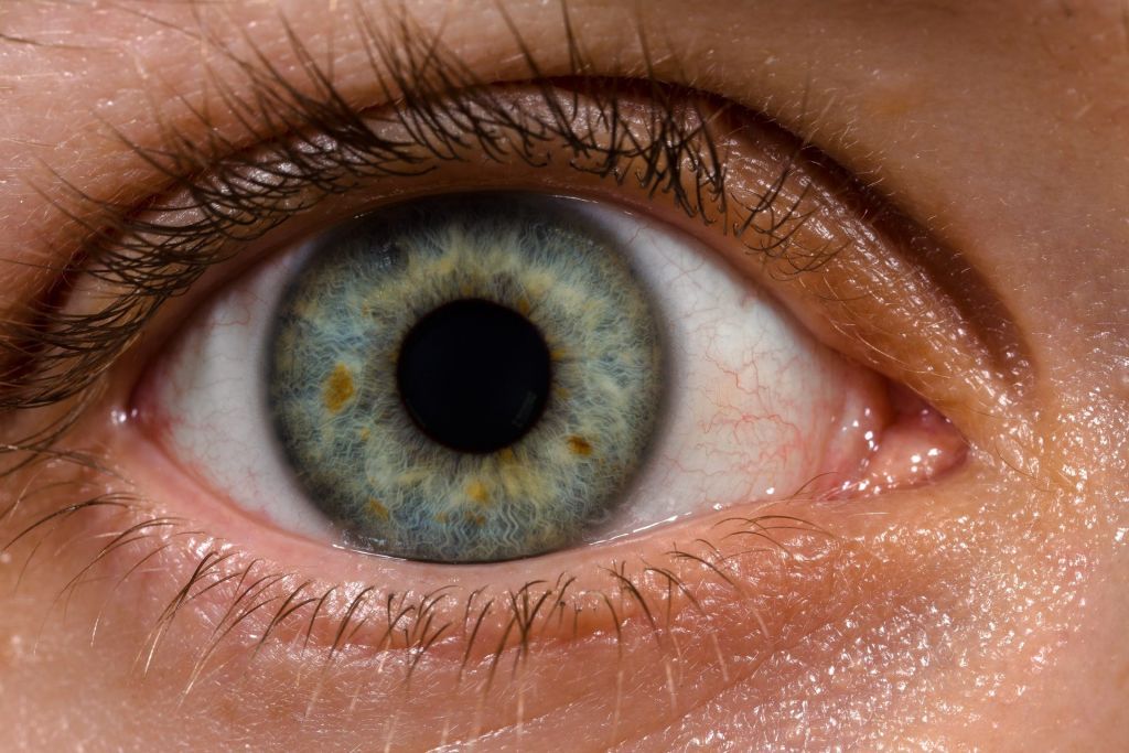 Κοροναϊός : Σημαντικές ανωμαλίες στα μάτια ορισμένων βαρέως νοσούντων ασθενών