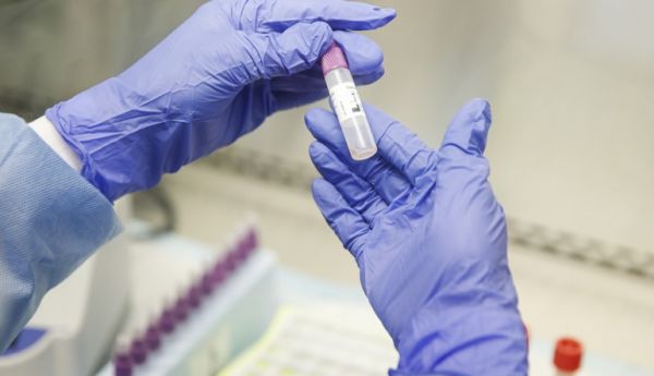 Αυτοαντισώματα και αυτοανοσία στον κοροναϊό – Μια σημαντική ανάλυση