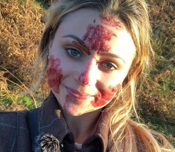 Αιματοβαμμένη κυνηγός ποζάρει με όπλα και νεκρά ζώα στα social