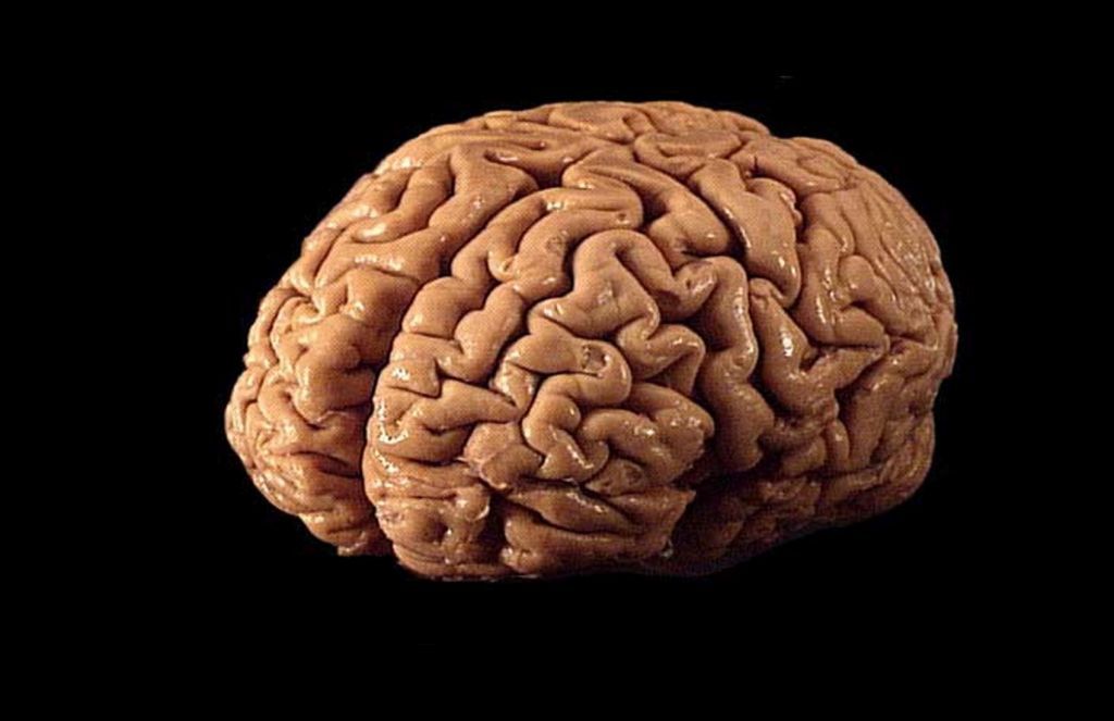 «Κύτταρα-ζόμπι» βρέθηκαν να αναπτύσσονται στον εγκέφαλο μετά τον θάνατο