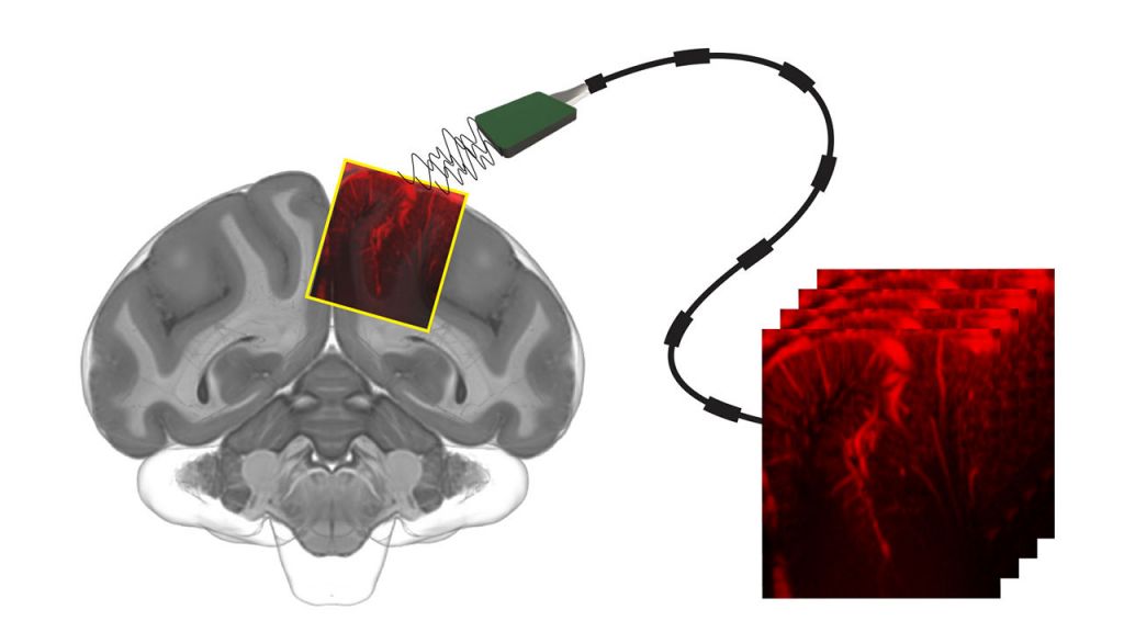 Συσκευή υπερήχων «διαβάζει τις προθέσεις μας στον εγκέφαλο»