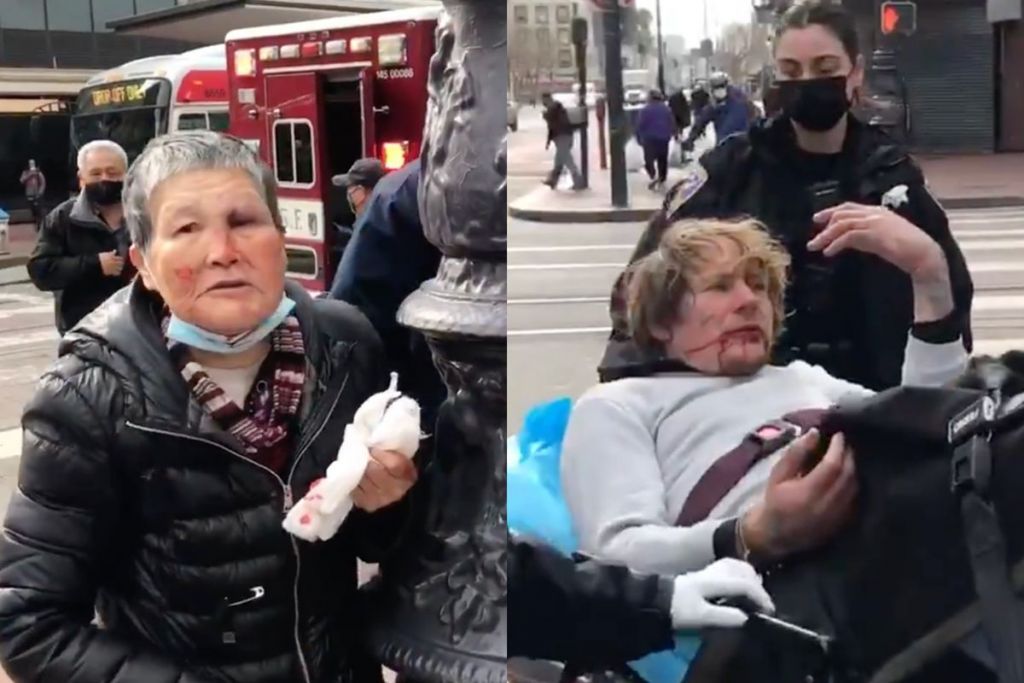 ΗΠΑ : Πήγε να επιτεθεί σε 75χρονη Ασιάτισσα αλλά… κατέληξε στο νοσοκομείο
