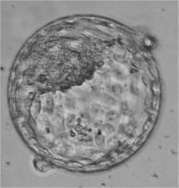 Επαναστατικό επιστημονικό επίτευγμα: Μοντέλο ανθρώπινου εμβρύου από… εργαστήριο