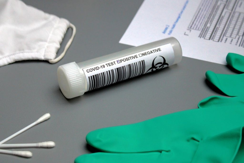 Μικροβιολόγοι: Αποτέφρωση χρειάζονται τα self test ως επικίνδυνα ιατρικά απόβλητα