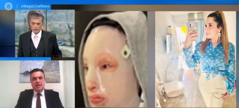 Επίθεση με βιτριόλι: Η Ιωάννα ζει σε ιδιότυπη φυλακή – Δεν μπορεί να βγει στον ήλιο