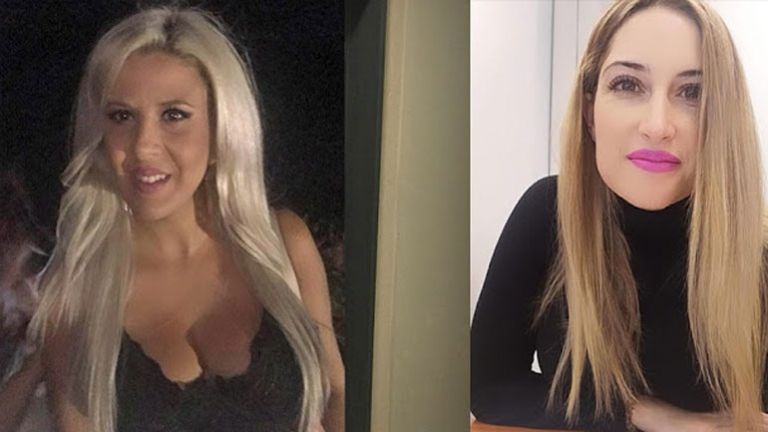 Επίθεση με βιτριόλι : Από τη σιωπή στη συγγνώμη – Η ομολογία της 35χρονης, ο Γολγοθάς της Ιωάννας