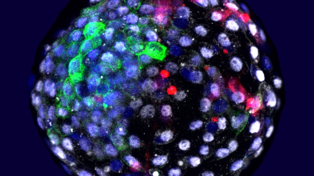 Έμβρυα από κύτταρα ανθρώπου και πιθήκου δημιουργήθηκαν για πρώτη φορά στο εργαστήριο