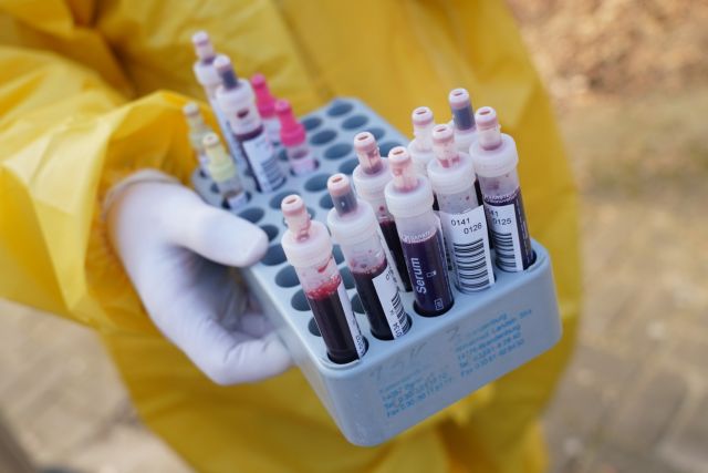 Κοροναϊός : Δεν φαίνεται να σχετίζεται η ομάδα αίματος με την πιθανότητα λοίμωξης