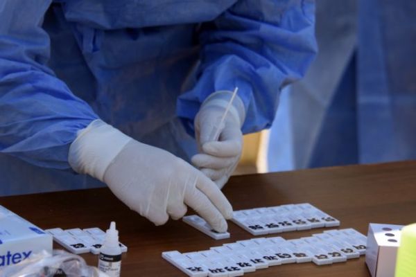 Πελώνη : Εντός της εβδομάδας τα self test σε εργαζόμενους – Τι είπε για το Πάσχα