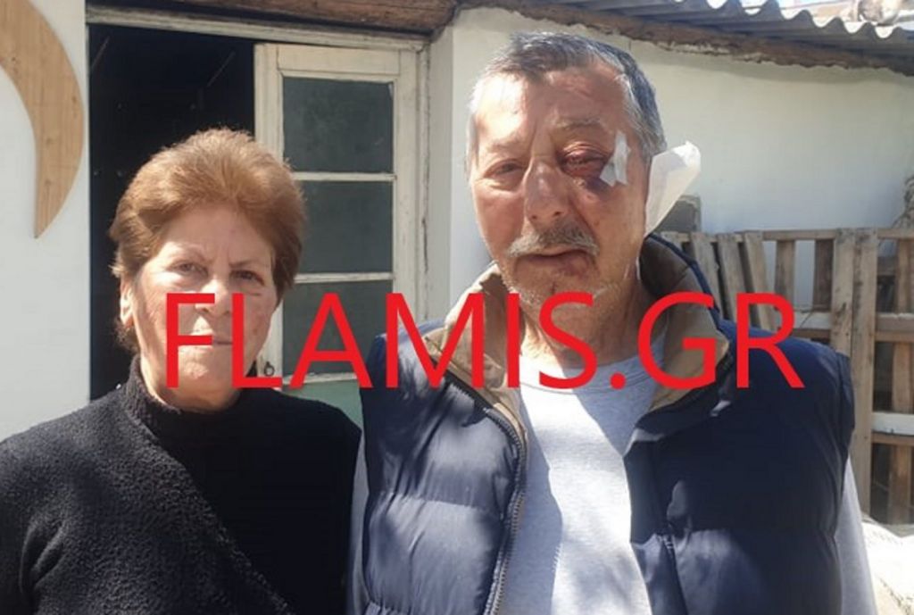 Αχαΐα : Λήστεψαν και βασάνιζαν ζευγάρι – Η γυναίκα αναγνώρισε δύο από τους δράστες