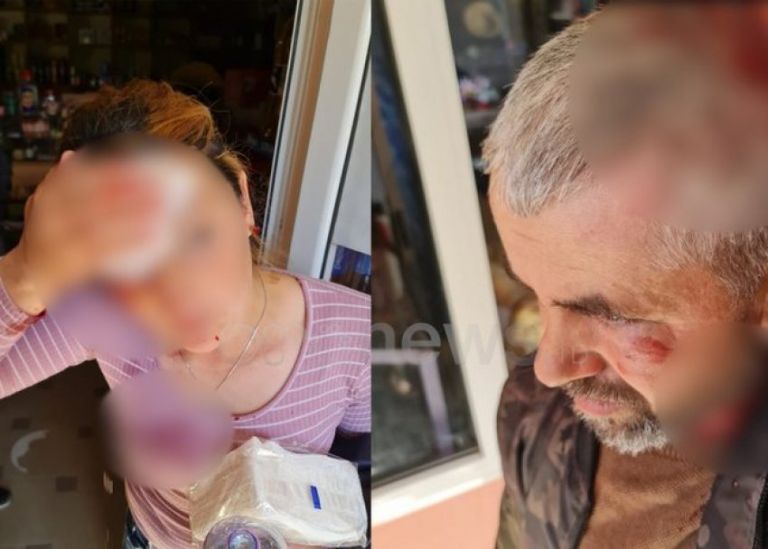 Αλβανία: Εκλογές με παρατράγουδα – Η τρελή πορεία αυτοκινήτου και μια επίθεση με… καρέκλες