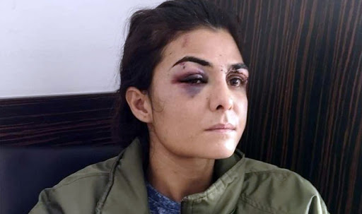 Τουρκία: Αποφυλακίστηκε η Μελέκ Ιπέκ που είχε σκοτώσει τον σύζυγο βασανιστή της