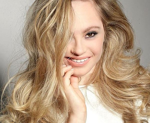 Mikayla Holmgren : Η 26χρονη καλλονή με σύνδρομο Down διεκδικεί να γίνει το πρώτο μοντέλο του Sports Illustrated Swimsuit