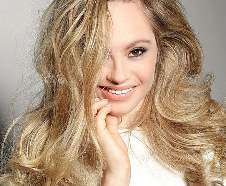 Mikayla Holmgren : Η 26χρονη καλλονή με σύνδρομο Down διεκδικεί να γίνει το πρώτο μοντέλο του Sports Illustrated Swimsuit