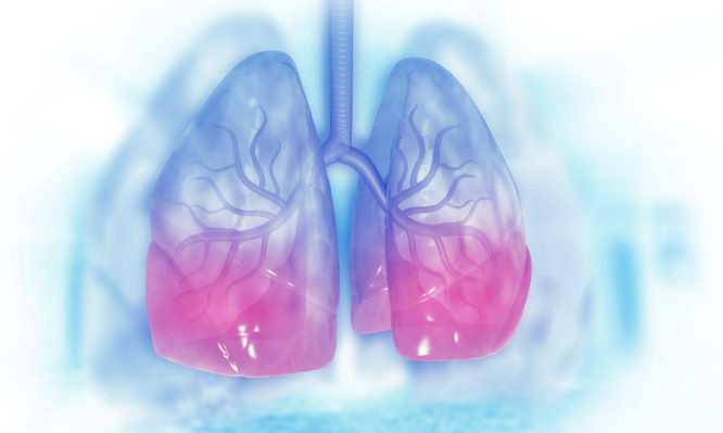 Συστατικό σε πασίγνωστη τροφή μπορεί να «νικήσει» τον καρκίνο του πνεύμονα
