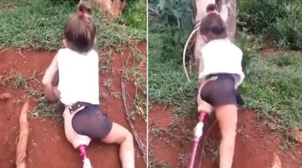 Τρισχαριτωμένο κοριτσάκι με προσθετικό πόδι καταφέρνει να σκαρφαλώσει – και το Twitter την αποθεώνει