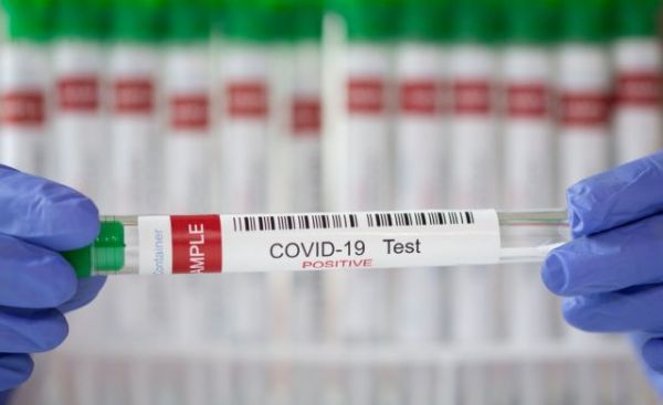 Ισπανία: Υπάλληλος φαρμακείου πουλούσε πλαστά πιστοποιητικά αρνητικού τεστ κοροναϊού σε ταξιδιώτες