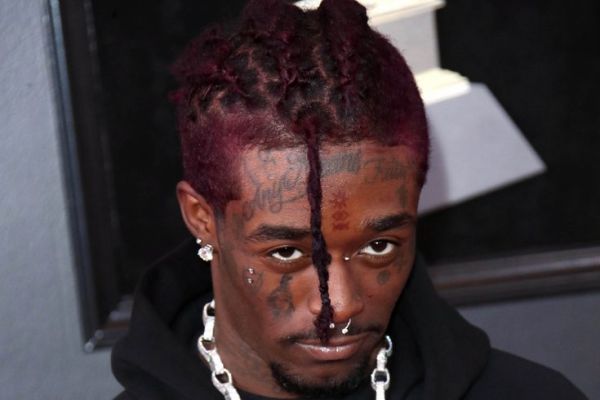 Lil Uzi Vert: Αφαίρεσε το διαμάντι αξίας 24 εκατ. δολαρίων που είχε εμφυτεύσει στο μέτωπό του