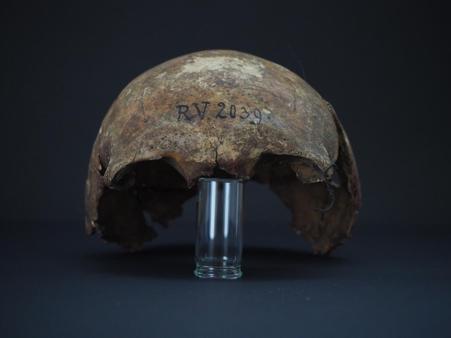 Σκελετός 5.000 ετών ανήκει στο αρχαιότερο γνωστό θύμα της πανώλης
