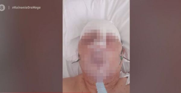 Παξοί: Αγρότης σακάτεψε αστυνομικό με σιδερολοστό – Καταδικάστηκε σε κάθειρξη εννέα ετών