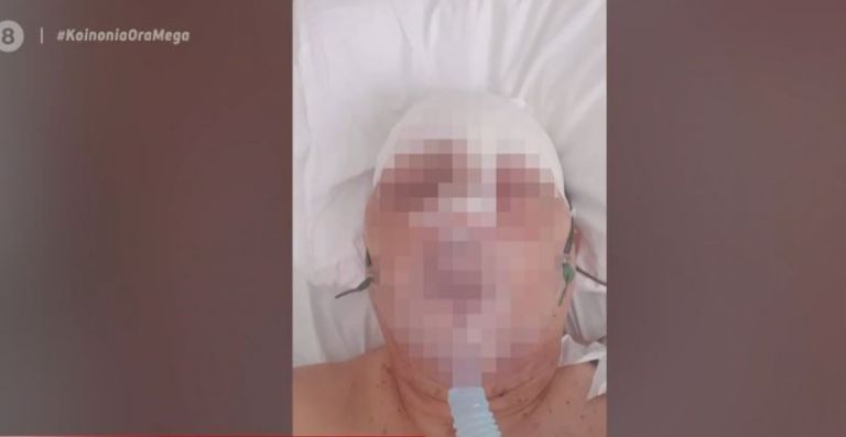 Παξοί: Αγρότης σακάτεψε αστυνομικό με σιδερολοστό – Καταδικάστηκε σε κάθειρξη εννέα ετών