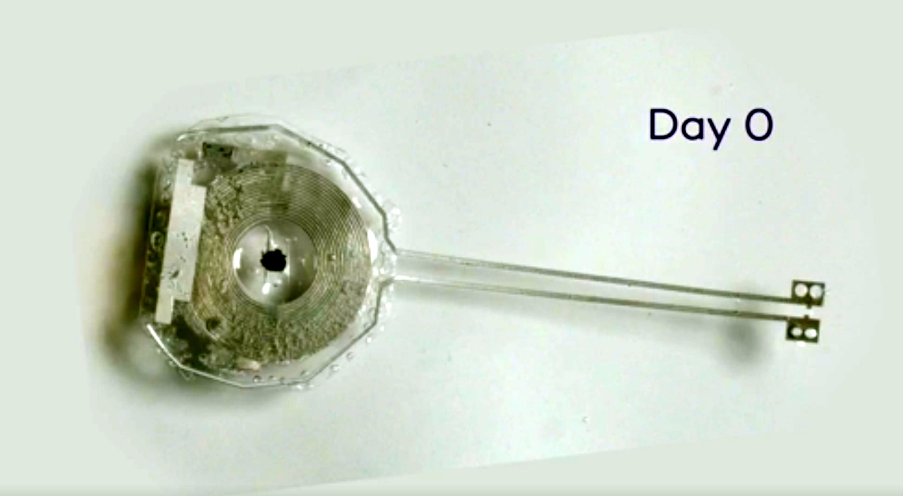 Πρωτοποριακός βηματοδότης αυτοκαταστρέφεται όταν πάψει να χρειάζεται