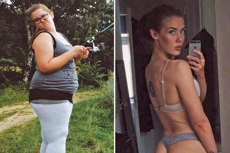 Παχύσαρκη μαθήτρια έχασε το μισό της βάρος με ένα κουταλάκι του γλυκού – Σήμερα είναι μοντέλο