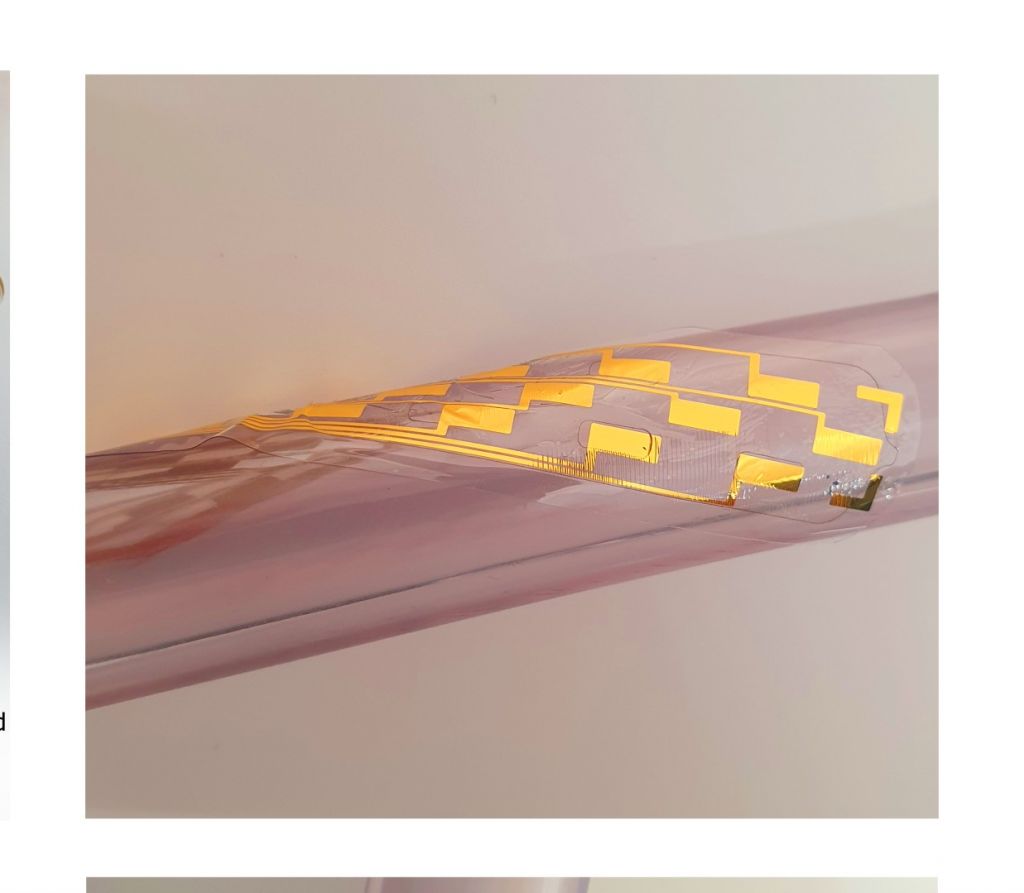 Βρετανία: Ανέπτυξαν μικροσκοπικό εμφύτευμα σπονδυλικής στήλης που καταπολεμά τους πόνους