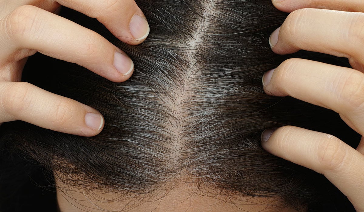 Έρευνα: Αναστρέψιμο το γκριζάρισμα των μαλλιών που οφείλεται στο άγχος