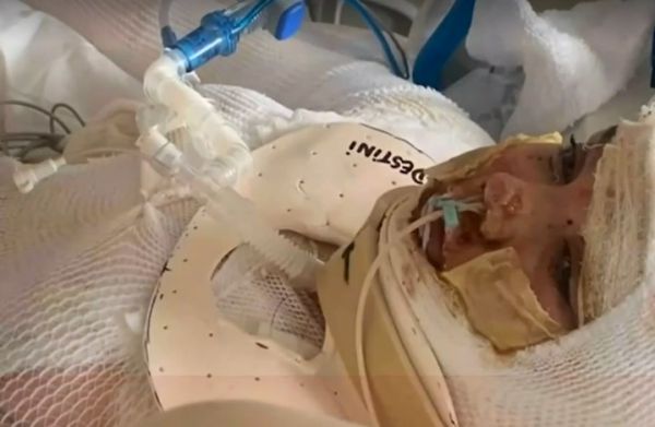 Tik Tok: Τι είναι η πρόκληση του «αναμμένου καθρέφτη» από την οποία κινδύνεψε να πεθάνει 13χρονη