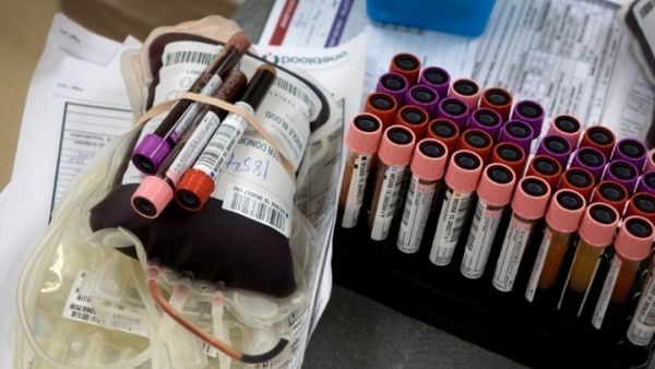 Έρευνα: Οι μεταγγίσεις αίματος είναι ασφαλείς από τον κοροναϊό