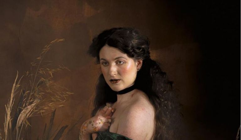 Γυναίκα φωτογραφίζεται με σπάνια δερματική πάθηση και συγκλονίζει