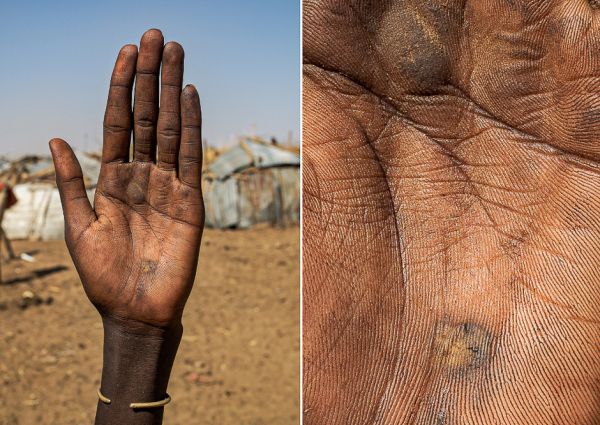 Omar Reda: Φωτογραφίζει ανθρώπινα χέρια και διηγείται την ιστορία ανθρώπων από όλο τον κόσμο