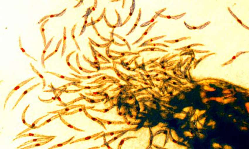 Ανοίγει νέος δρόμος για την επίτευξη ανοσίας στην ελονοσία | in.gr